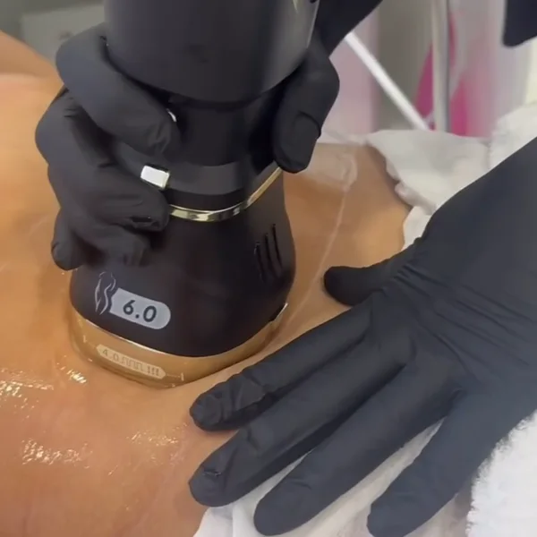 Estética não invasiva